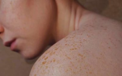 Taking Skin Health Seriously